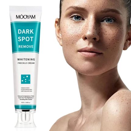MOOYAM Dark Spot Removal Whitening Freckle Cream 30g